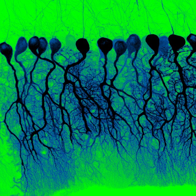 Neurons